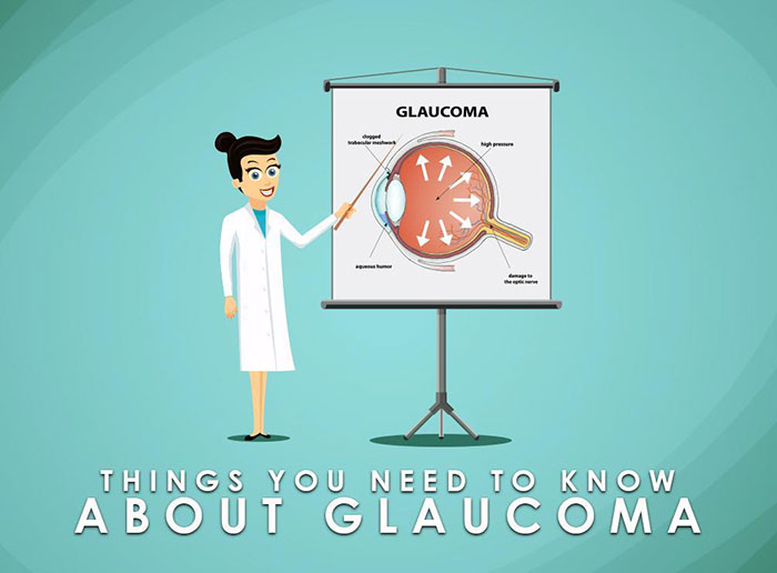 Things You Need to Know About Glaucoma