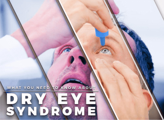 What You Need to Know About Dry Eye Syndrome