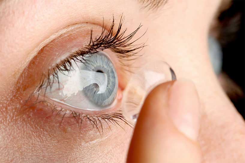 Contact Lenses